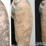 Фото удаление татуировки 21.11.2018 №023 - photo tattoo removal - tatufoto.com