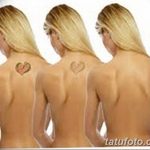 Фото удаление татуировки 21.11.2018 №031 - photo tattoo removal - tatufoto.com