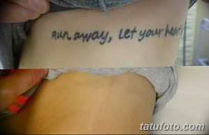 Фото тату до и после удаления: фраза 'run away, let your heart' на боку, процесс удаления и чистая кожа. Профессиональное удаление татуировок.