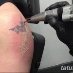 Фото удаление татуировки 21.11.2018 №046 - photo tattoo removal - tatufoto.com