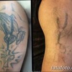 Фото удаление татуировки 21.11.2018 №054 - photo tattoo removal - tatufoto.com