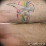 Фото удаление татуировки 21.11.2018 №061 - photo tattoo removal - tatufoto.com