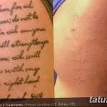 Фото удаление татуировки 21.11.2018 №068 - photo tattoo removal - tatufoto.com