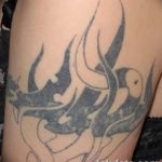 Фото удаление татуировки 21.11.2018 №078 - photo tattoo removal - tatufoto.com