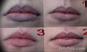 Фотография татуажа губ до и после процедуры удаления лазером. Видно осветление пигмента и восстановление естественного цвета губ.