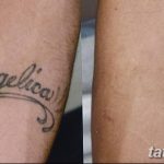 Фото удаление татуировки 21.11.2018 №089 - photo tattoo removal - tatufoto.com