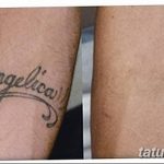 Фото удаление татуировки 21.11.2018 №091 - photo tattoo removal - tatufoto.com