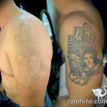 Фото удаление татуировки 21.11.2018 №093 - photo tattoo removal - tatufoto.com