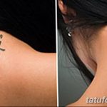 Фото удаление татуировки 21.11.2018 №097 - photo tattoo removal - tatufoto.com