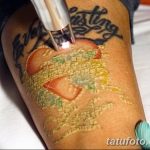 Фото удаление татуировки 21.11.2018 №105 - photo tattoo removal - tatufoto.com