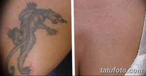 Фотография демонстрирует процесс удаления татуировки с плеча. Слева - татуировка с изображением пантеры, справа - кожа после первого сеанса удаления.