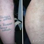 Фото удаление татуировки 21.11.2018 №113 - photo tattoo removal - tatufoto.com