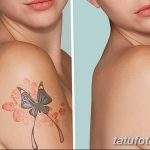 Фото удаление татуировки 21.11.2018 №121 - photo tattoo removal - tatufoto.com