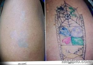 Фото удаление татуировки 21.11.2018 №125 - photo tattoo removal - tatufoto.com