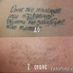 Фото удаление татуировки 21.11.2018 №131 - photo tattoo removal - tatufoto.com