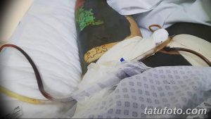 Фото татуировки в виде пазла на руке пациента, лежащего в больничной койке. Видны медицинские трубки и оборудование.
