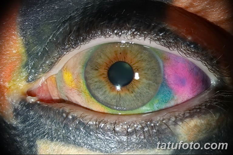 Разноцветные глазные яблоки – опыт (история) Мэтта Гоне