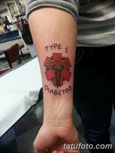Фото тату: татуировка медицинского креста с надписью "Type 1 Diabetes" на руке, выполненная в черном и зеленом цветах.