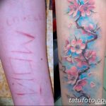 фото тату на шраме 29.04.2019 №004 - scar tattoo - tatufoto.com
