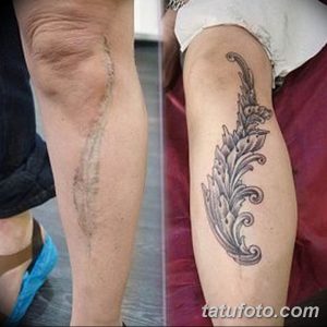 Фото татуировки в виде изящного завитка, выполненного в технике blackwork, скрывающего шрамы на ноге. Элегантный и минималистичный рисунок тату.