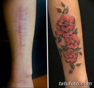 Фото тату цветущей ветки на руке, выполненное в нежных розовых и зеленых тонах. Рисунок маскирует шрам, придавая руке эстетичный вид. Идеально для любительниц цветочных мотивов.