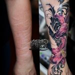 фото тату на шраме 29.04.2019 №013 - scar tattoo - tatufoto.com