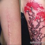 фото тату на шраме 29.04.2019 №018 - scar tattoo - tatufoto.com