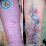 фото тату на шраме 29.04.2019 №022 - scar tattoo - tatufoto.com