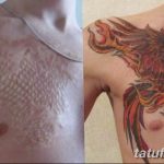 фото тату на шраме 29.04.2019 №025 - scar tattoo - tatufoto.com