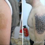 фото тату на шраме 29.04.2019 №027 - scar tattoo - tatufoto.com
