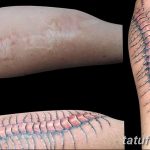 фото тату на шраме 29.04.2019 №030 - scar tattoo - tatufoto.com
