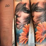 фото тату на шраме 29.04.2019 №036 - scar tattoo - tatufoto.com