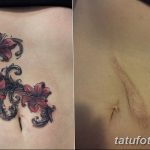 фото тату на шраме 29.04.2019 №044 - scar tattoo - tatufoto.com