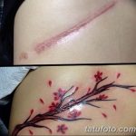 фото тату на шраме 29.04.2019 №056 - scar tattoo - tatufoto.com
