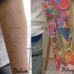 фото тату на шраме 29.04.2019 №060 - scar tattoo - tatufoto.com