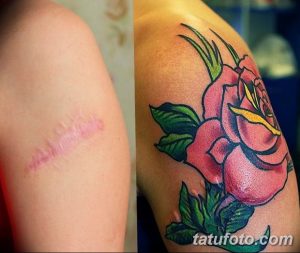 Фото тату с изображением розовой розы на плече, скрывающее шрам. Татуировка выполнена в ярких, насыщенных цветах.