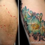 фото тату на шраме 29.04.2019 №066 - scar tattoo - tatufoto.com