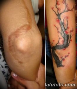 Фото тату с изображением цветущей сакуры на руке, скрывающее шрам. Татуировка выполнена в ярких, красочных тонах.