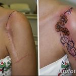 фото тату на шраме 29.04.2019 №070 - scar tattoo - tatufoto.com