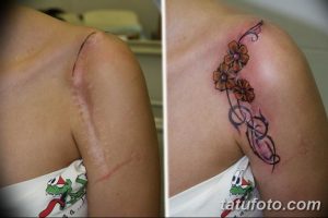 Фото тату с изображением цветущей ветки с цветами на плече, скрывающее шрам. Татуировка выполнена в ярких, красочных тонах.