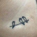 фото тату на шраме 29.04.2019 №093 - scar tattoo - tatufoto.com