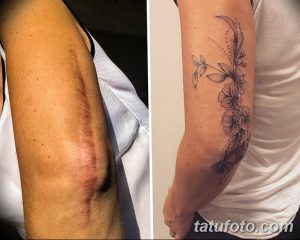 Фото тату цветов на руке, маскирующее шрамы. Элегантный рисунок в стиле графика, выполненный опытным мастером тату.