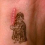 фото тату на шраме 29.04.2019 №098 - scar tattoo - tatufoto.com