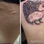 фото тату на шраме 29.04.2019 №099 - scar tattoo - tatufoto.com