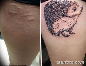 Фото тату с изображением милого ежика на руке, выполненное для маскировки шрама. Детализированный рисунок в черно-белой гамме.