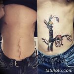 фото тату на шраме 29.04.2019 №103 - scar tattoo - tatufoto.com