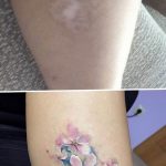 фото тату на шраме 29.04.2019 №105 - scar tattoo - tatufoto.com