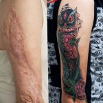 фото тату на шраме 29.04.2019 №107 - scar tattoo - tatufoto.com