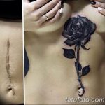 фото тату на шраме 29.04.2019 №108 - scar tattoo - tatufoto.com