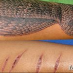 фото тату на шраме 29.04.2019 №113 - scar tattoo - tatufoto.com